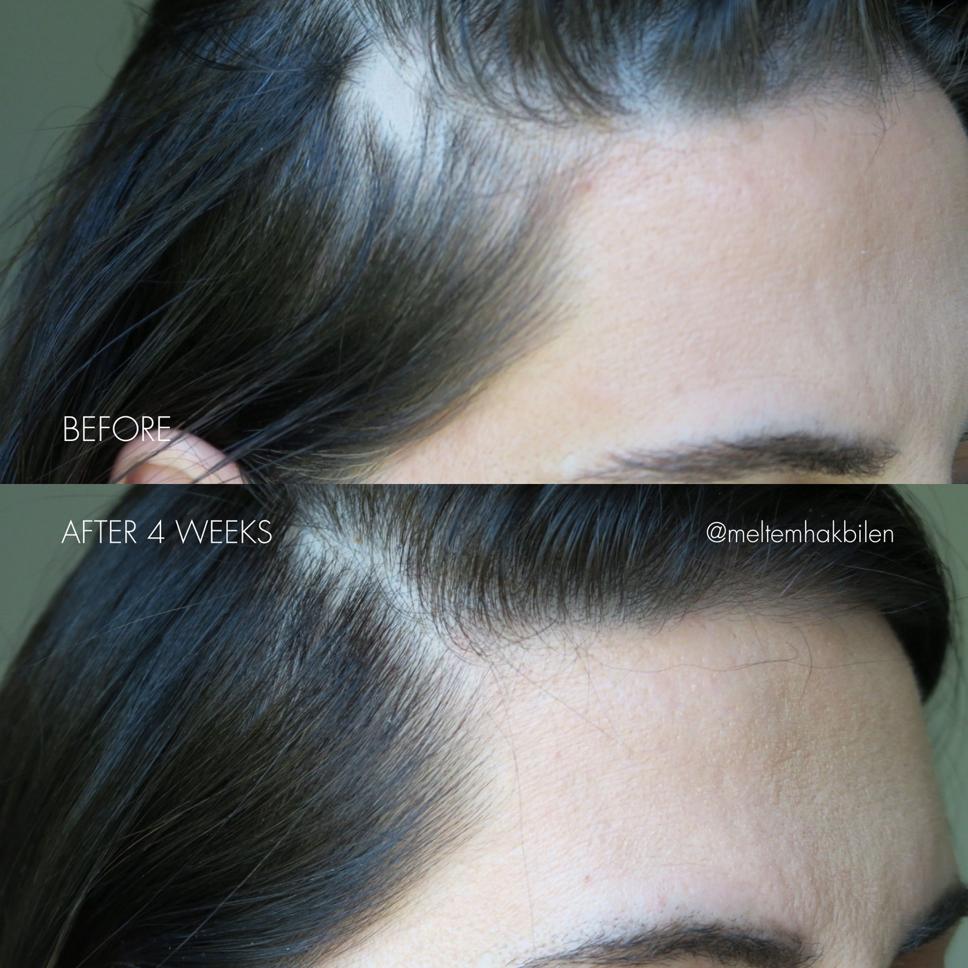 The Hair Serum