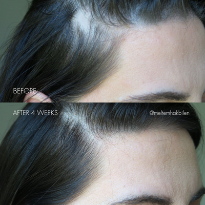 The Hair Serum