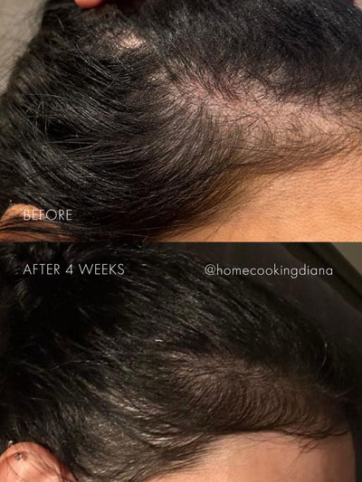 The Hair Serum