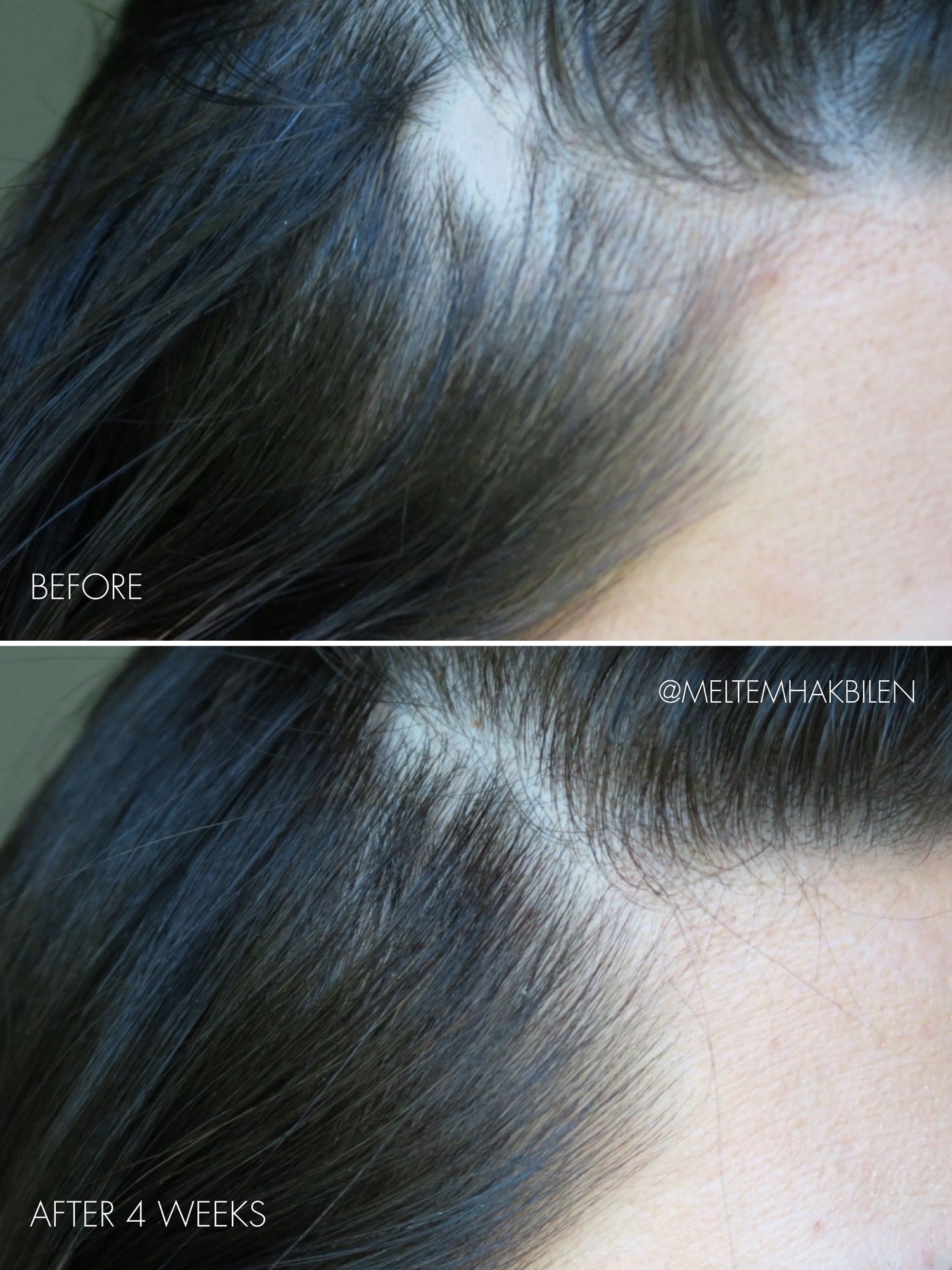 The Hair Serum