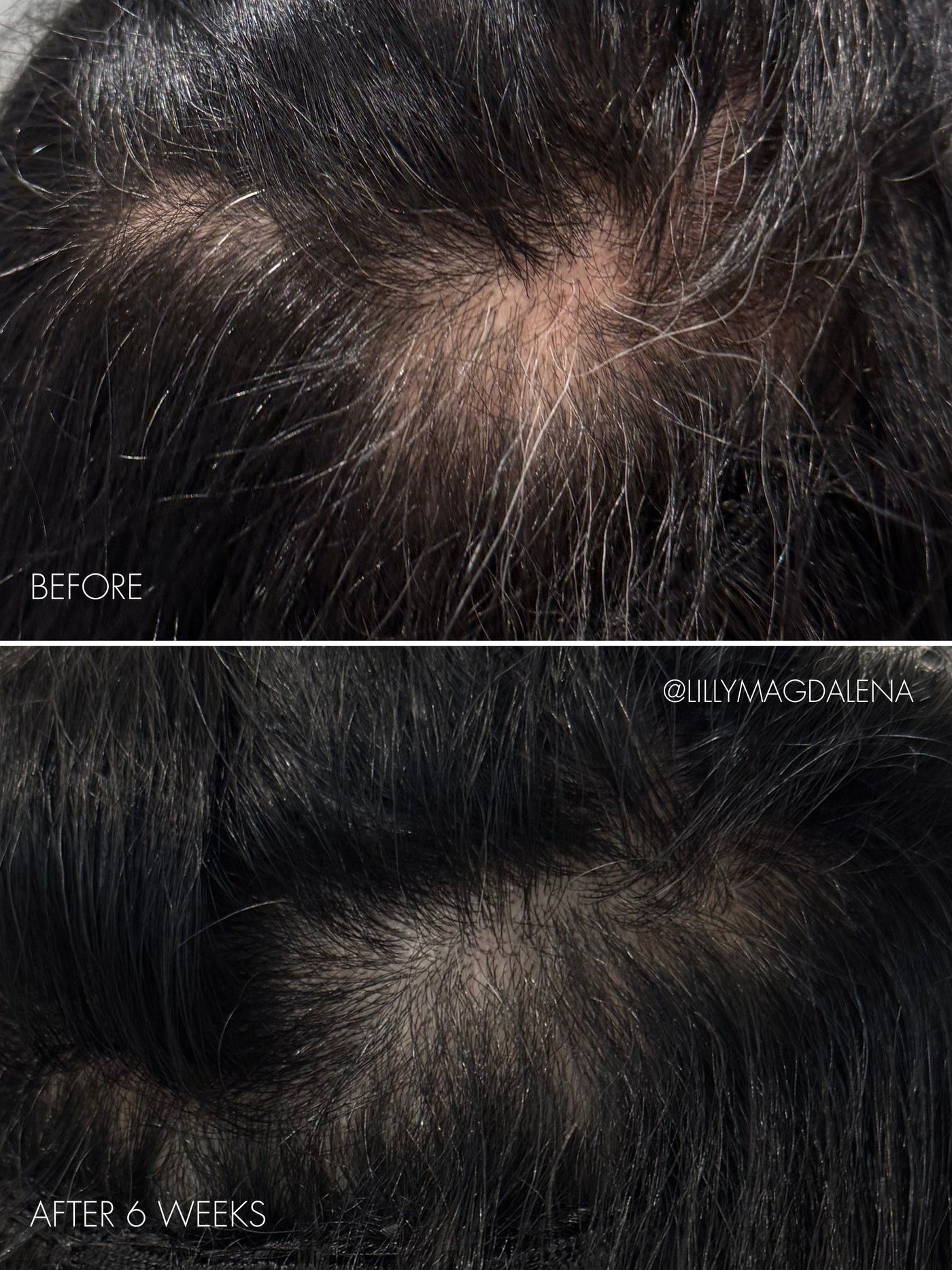 The Hair Serum